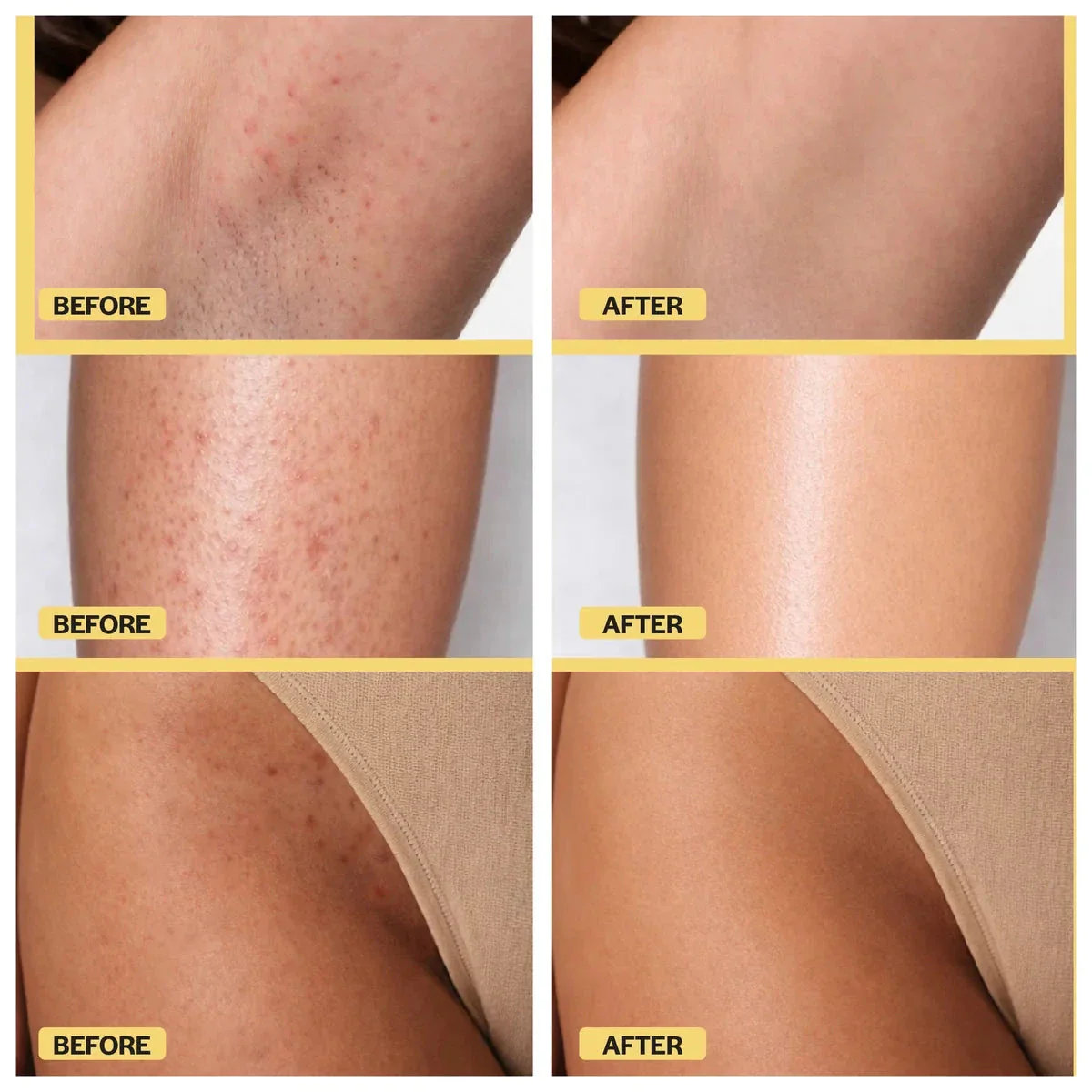 Bikini Line Recovery Kit - Image 6