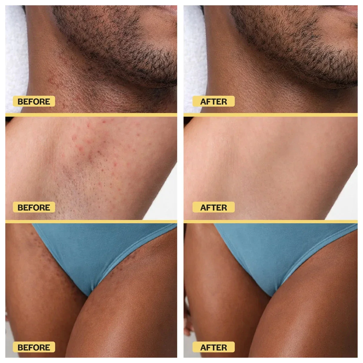 Ingrown Hair Reset Duo - Image 16