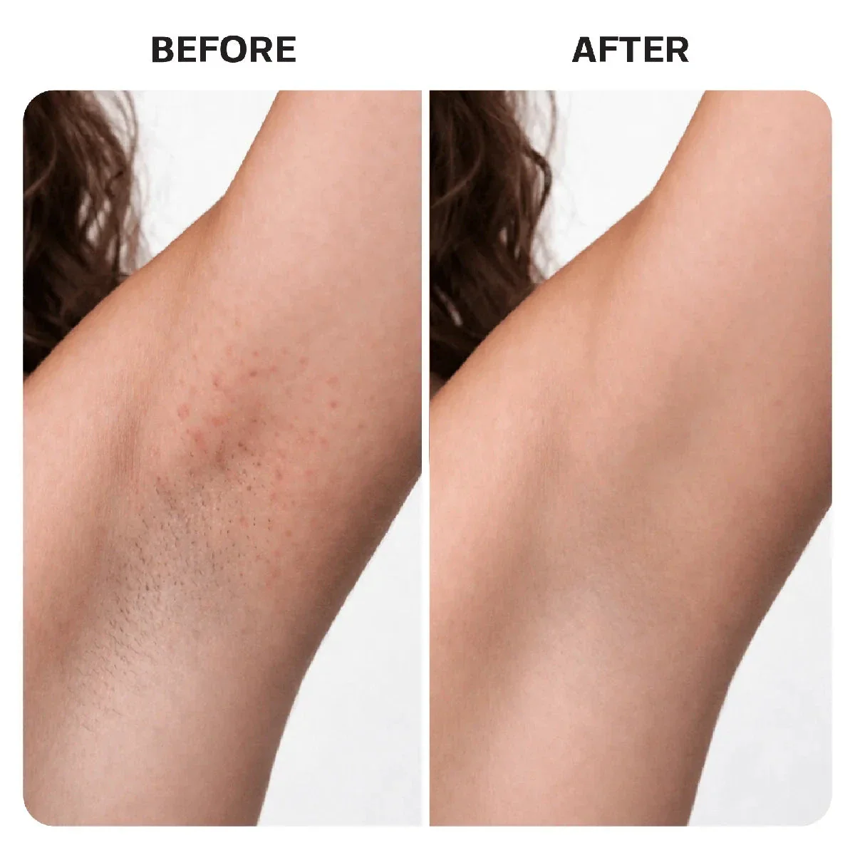 Ingrown Hair Reset Duo - Image 18