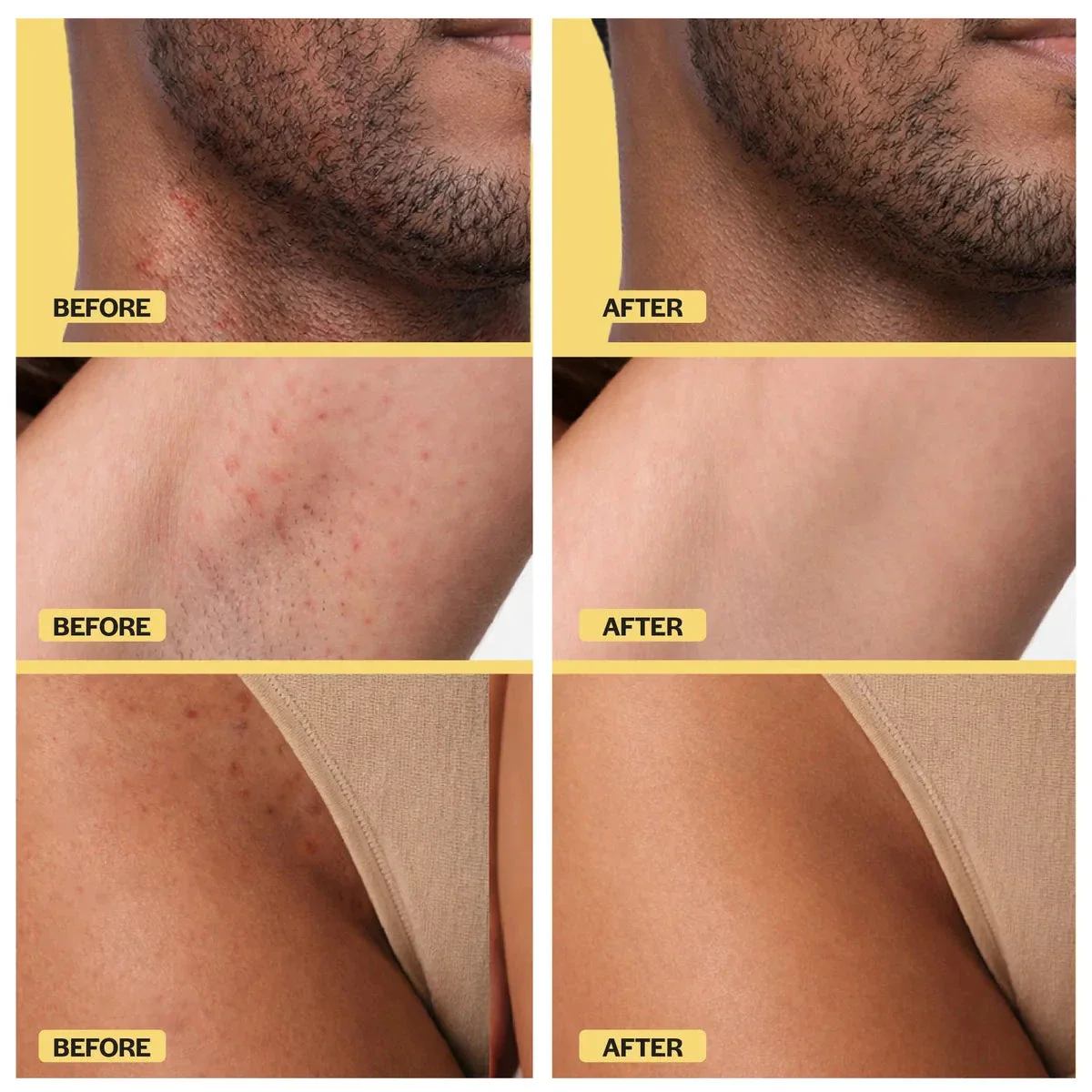 Ingrown Hair Roller Serum - Image 6