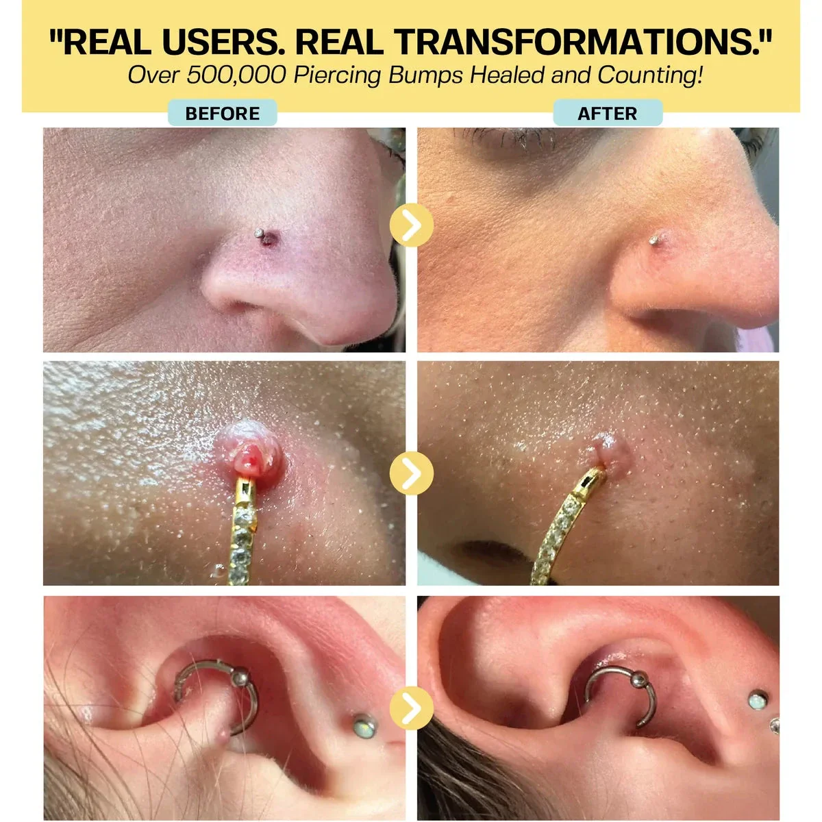 Keloid Repair Duo - Image 11