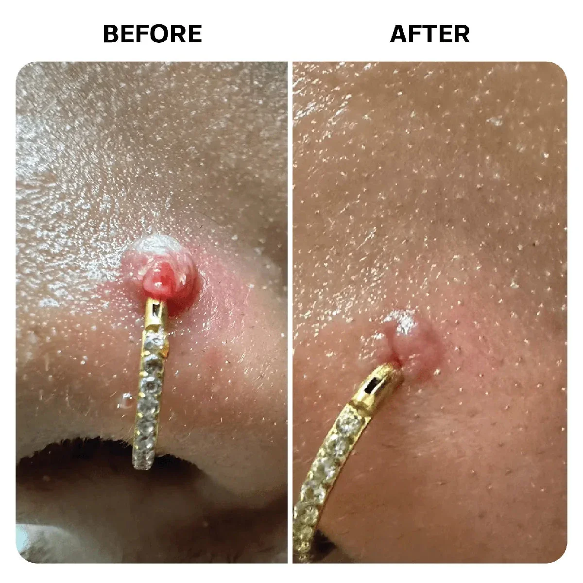 Keloid Repair Duo - Image 12