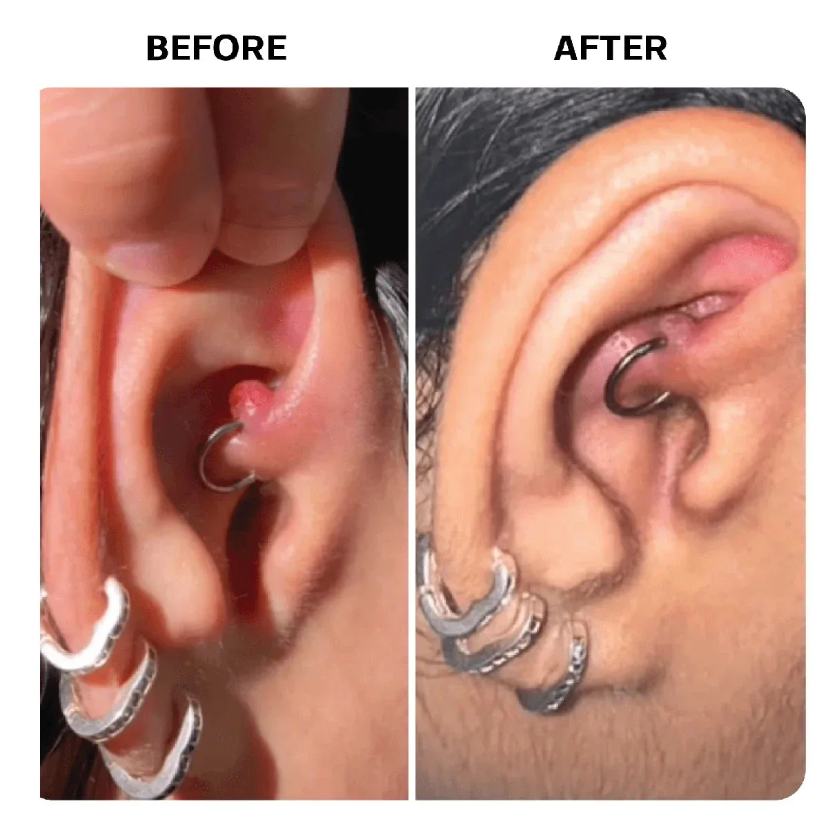 Keloid Repair Duo - Image 13