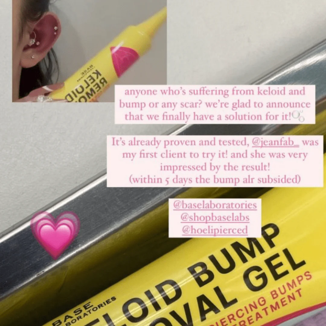 Keloid Bump & Scar Reducing Gel (2oz) Wholesale - Image 3