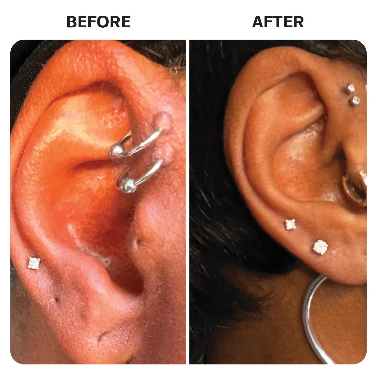 Piercing Aftercare Hypochlorous Acid Spray - Image 5