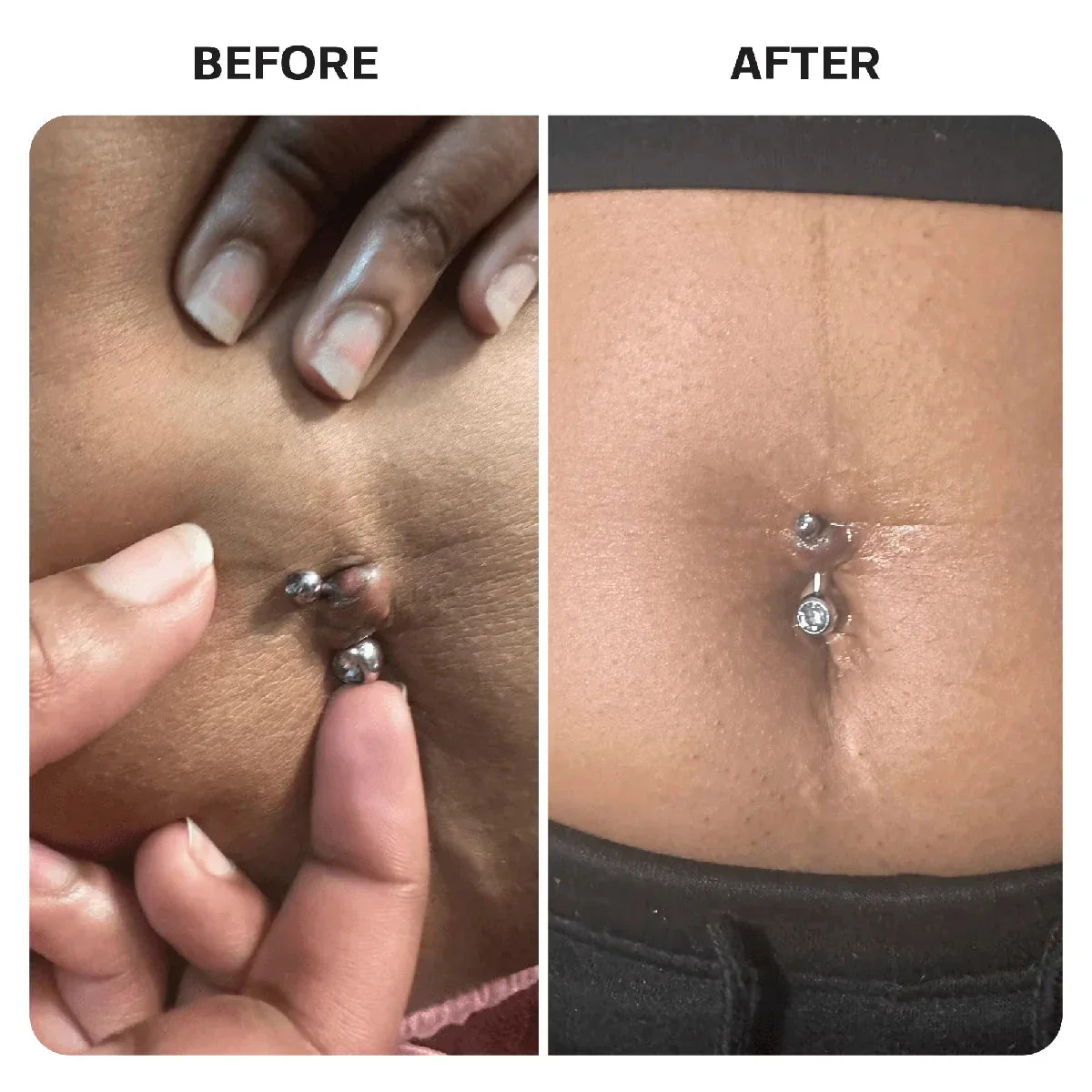 Piercing Aftercare Hypochlorous Acid Spray - Image 6
