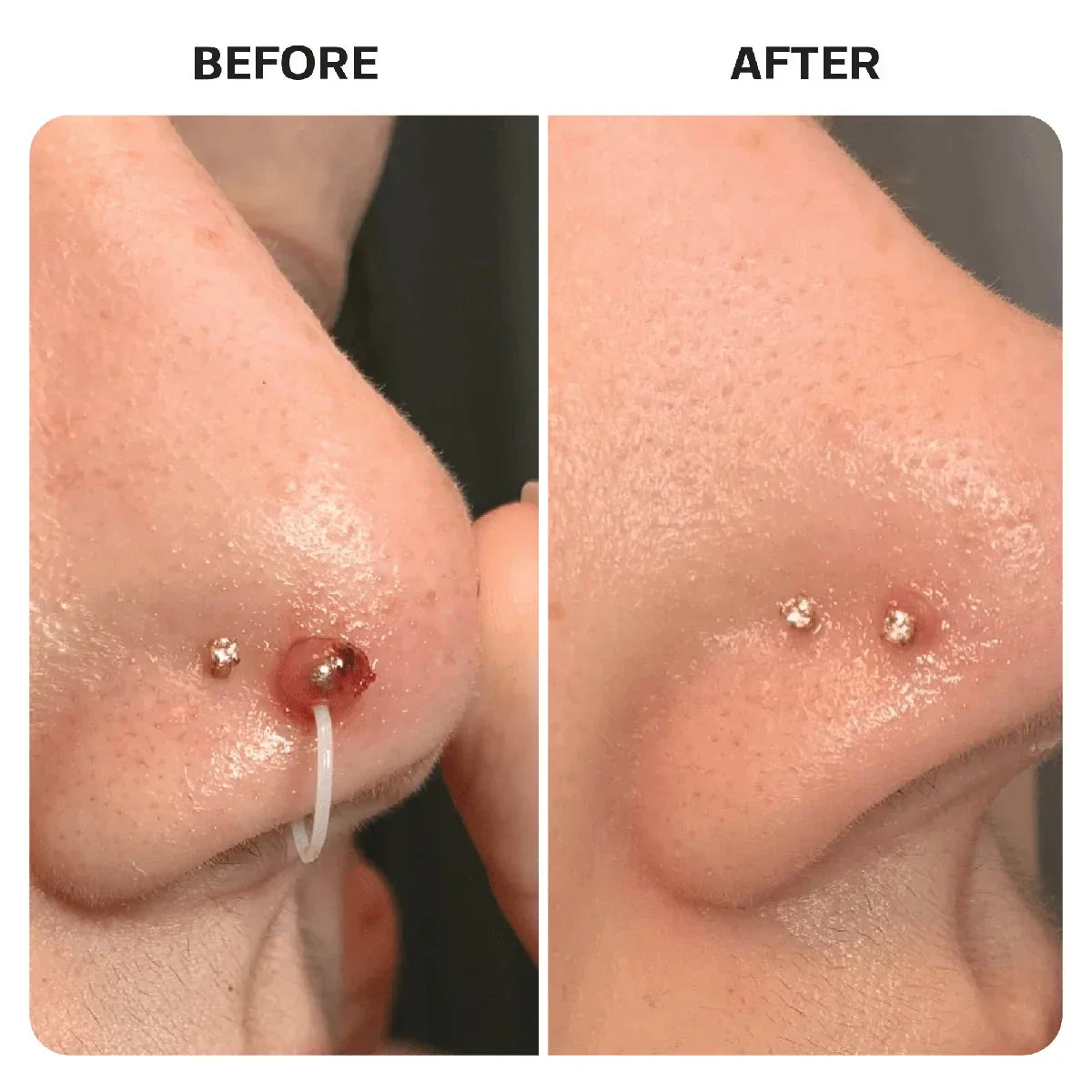 Piercing Aftercare Hypochlorous Acid Spray - Image 7