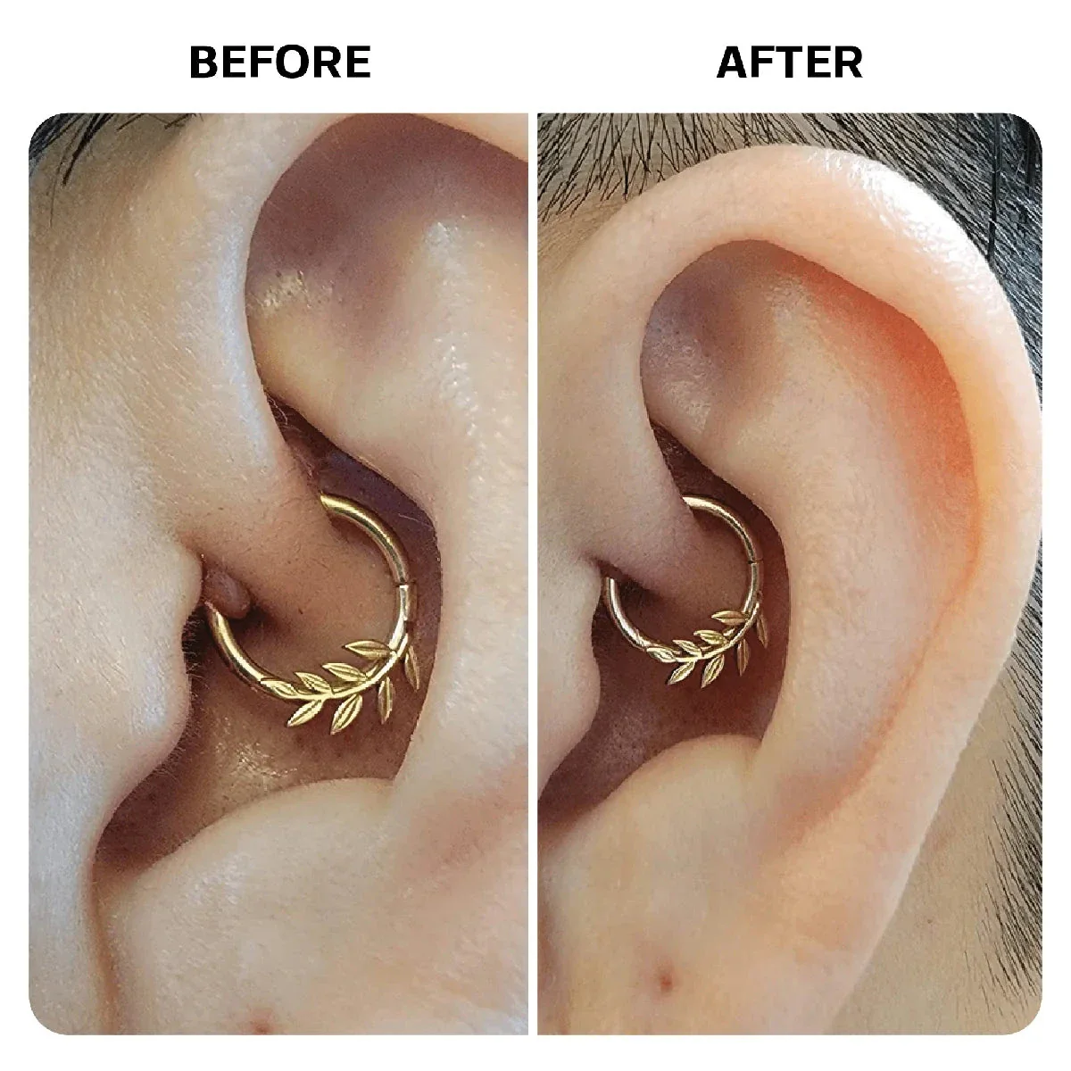 Piercing Bump Recovery Duo - Image 8