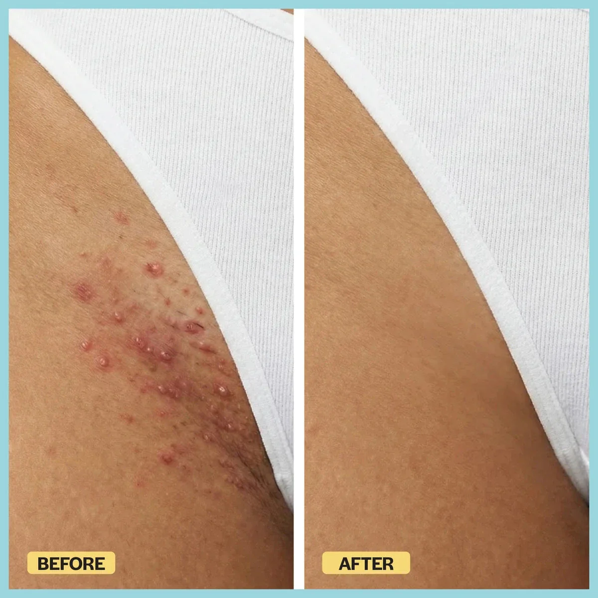 Razor Bump Rescue Duo - Image 13